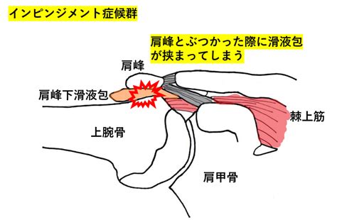 ボールを投げると肩が痛い！なかなか治らない野球肩で困っている選手へ！悪化する前にすぐにでも治療しましょう！ すみだ整骨院 直方飯塚