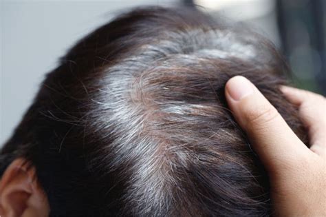 how to stop premature graying of hair