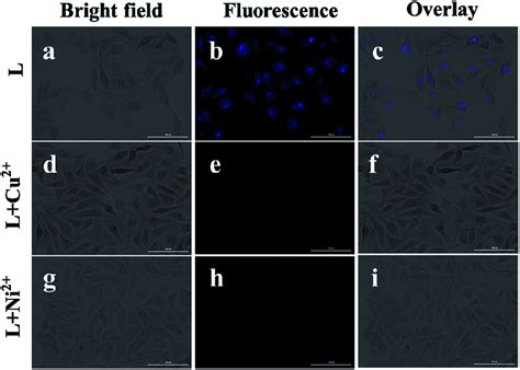 Fluorescence Images Of The Living T 24 Cells Incubated With L 5 μm