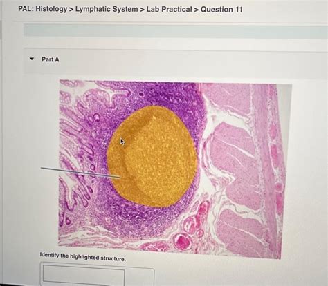 Solved Pal Histology Lymphatic System Lab Practical Chegg