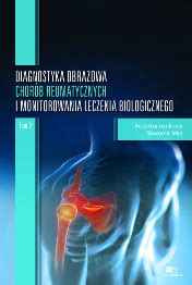 Diagnostyka Obrazowa Chor B Reumatycznych I Monitorowania Leczenia