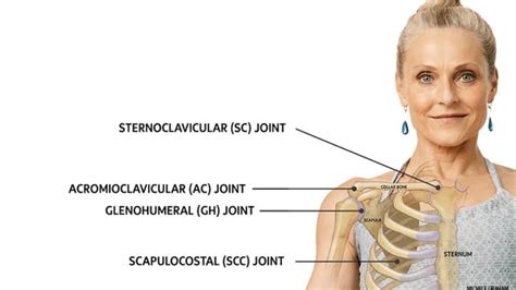 Dislocation Of Sternoclavicular Joint And Acromioclavicular Joint