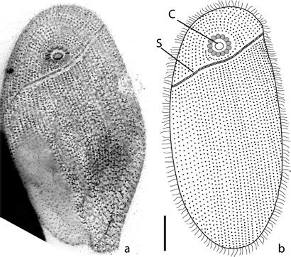 Light microscopy of the ventral surface of Chatton-Lwoff-stained... | Download Scientific Diagram