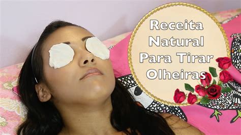 Receita Natural Para Acabar As Olheiras YouTube