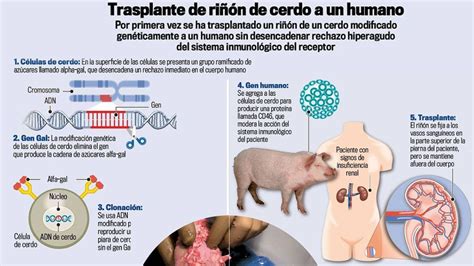 Hito Realizan El Primer Trasplante De Un Ri N De Cerdo Modificado