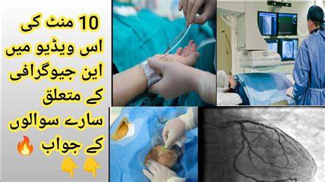 What Is Angiography Angiography Kaisay Ki Jati Ha What Is