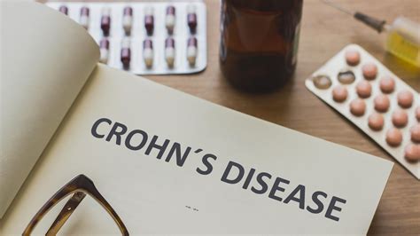 Crohns Disease Causes And Treatments Phlo Blog