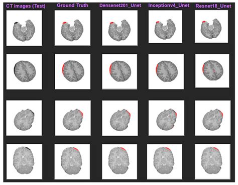 Diagnostics Free Full Text A Deep Learning Based Automatic