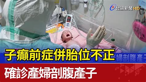 子癲前症併胎位不正 確診產婦剖腹產子 Youtube