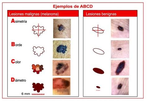 Centro Dermatol Gico Dr Ram Rez Medina Secci N Hombres Control De