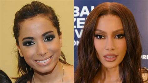 Lisa Gomes Antes E Depois Cirurgia - Cirurgias plásticas dos famosos: Antes e depois impressionantes ...