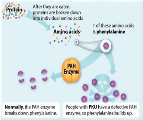 Phenylketonuria (PKU) – Decode Genomics