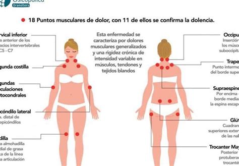 Tratamiento Eficaz Estimulaci N De Acupuntura Para Enfermedades Del