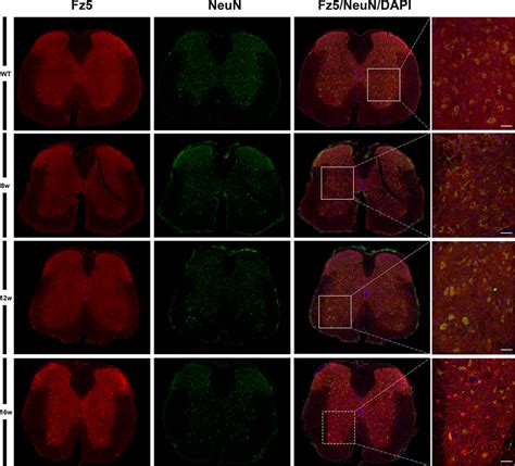 Neuronal Location Of Fz Receptor In The Spinal Cord Of Both Wt And Als