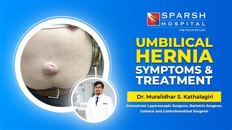 Umbilical Hernia Symptoms And Treatment Dr Muralidhar S Kathalagiri