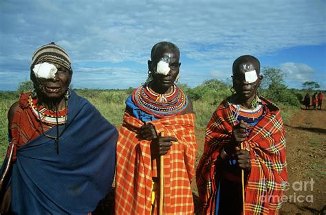 Eye Surgery Patients 2 By Jason Kelvin Science Photo Library