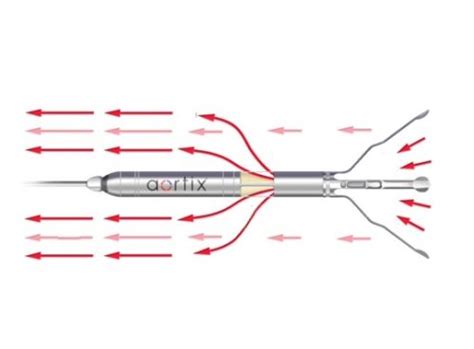 Procyrion S Aortix Percutaneous Mechanical Circulatory Support Device