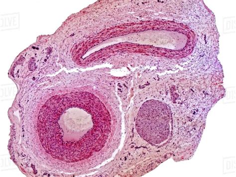 Nerve Bundle Histology Labeled