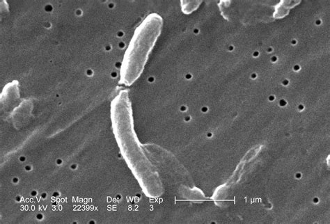 Free Picture Micrograph Two Vibrio Cholerae Bacteria