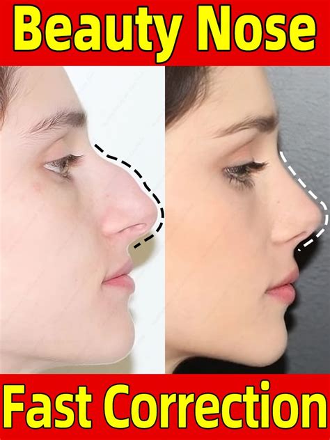 Nose Lift Up Essential Oil Beautiful Nose Shape Hump Nose Correction