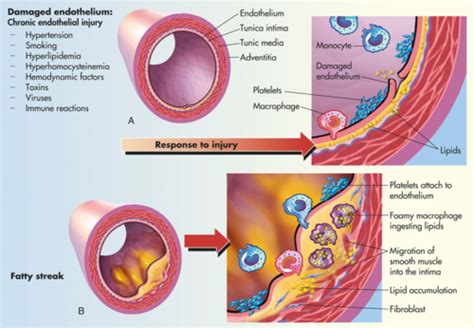 Clin Med Arterial Disease Flashcards Quizlet