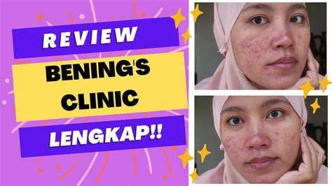 REVIEW LENGKAP BENING S CLINIC Hasil Treatment YouTube