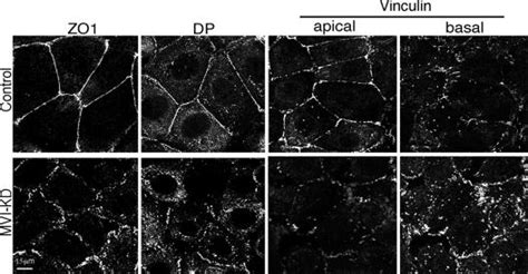 Myosin Vi Supports The Integrity Of Apical Junctional Complexes Myosin