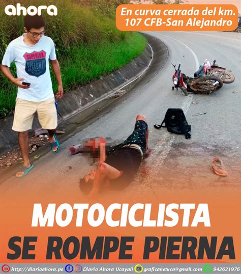 Motociclista Se Rompe Pierna Diario Ahora