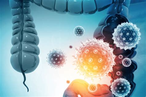 ECM GRATUITO Carcinoma Del Colon Diagnostica E Oncologia Di