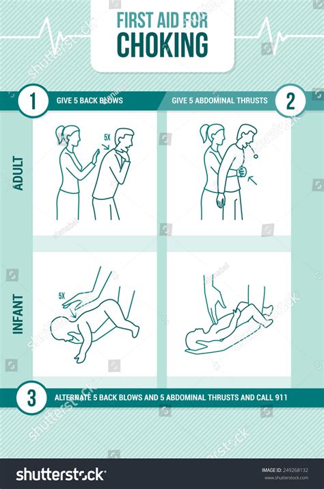 First Aid Procedure For Choking And Heimlich Maneuver For Adults And Infants Stock Vector