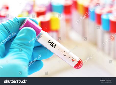 Blood Sample Positive Psa Prostatespecific Antigen Stock Photo