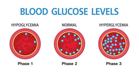 Hyperglycemia High Blood Sugar And Diabetes Obesity Is A Serious