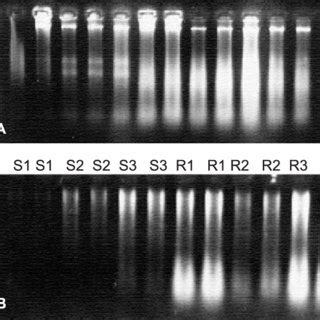 Ethidium Bromide Stained Agarose Gels Showing Dna Rna Yields