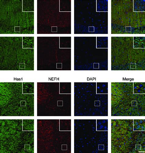 Tau P S Promotes The Accumulation Of Has In Cell Body In Wks Old