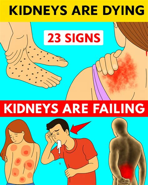 HealthPriceless - 23 Weird Signs of Kidney Disease Most People Will