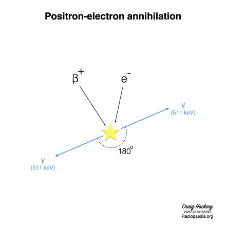 Positron Emission Tomography Radiology Reference Article