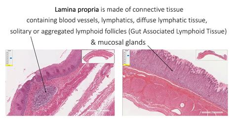 Histology With Chimmalgi General Plan Of Alimentary Canal Youtube