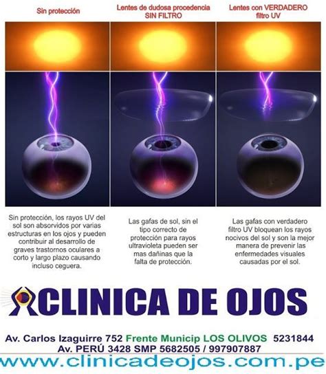 Clínica de Ojos Oftalmic Láser FILTRO UV Actividades del cuerpo