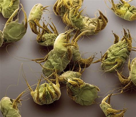 Sarcoptic Mange Mites, Sem Photograph by Steve Gschmeissner