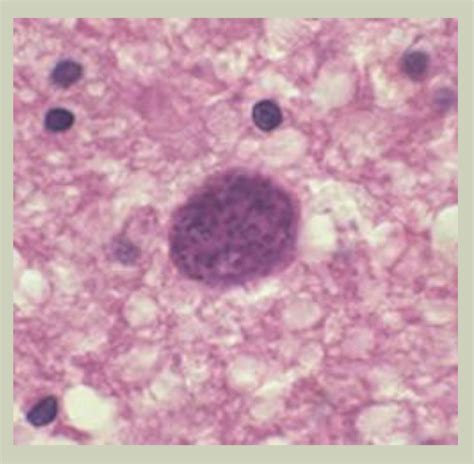 Exam 3 Coccidia IV Toxoplasma Gondii Flashcards Quizlet