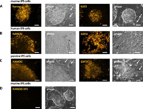 Analysis Of Pluripotency Gene Expression In Ips Cells Of Different