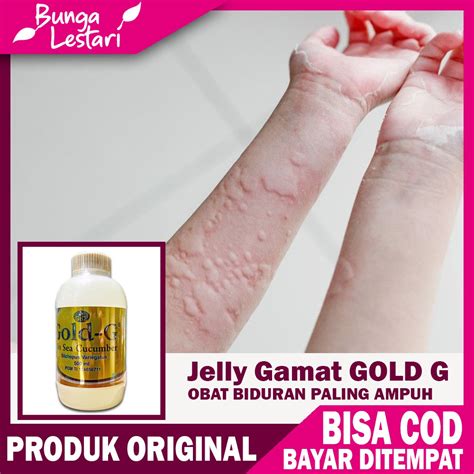 COD Obat Biduran Kaligata Dan Keringat Buntet Manjur Herbal Jelly