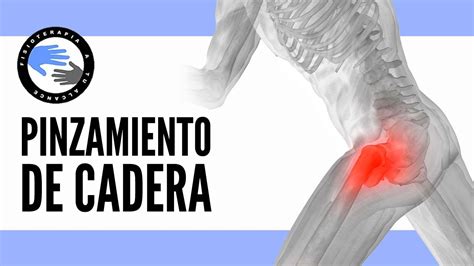 Pinzamiento De Cadera Ejercicios Para Aliviar El Dolor Youtube