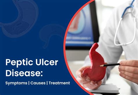 Peptic Ulcer Disease Symptoms Causes And Treatment Dr Vijaykumar