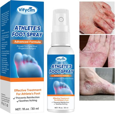 Athletes Foot Treatment Spray Anti Fungi Athletes Foot