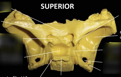 Superior Sphenoid Diagram Quizlet