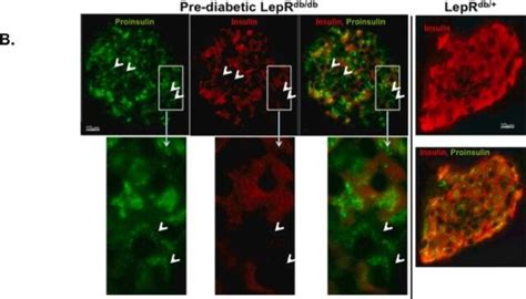 单克隆抗 胰岛素 小鼠抗Monoclonal Anti Insulin antibody produced in mouse