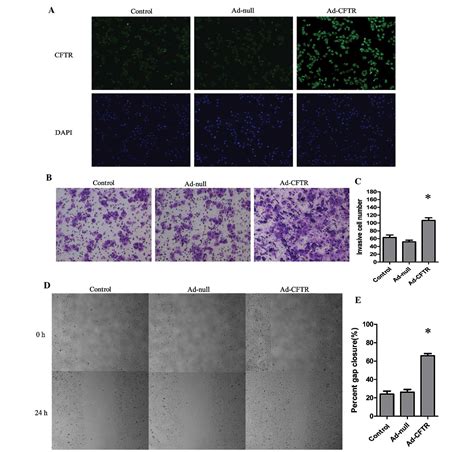 Adenovirusmediated Overexpression Of Cystic Fibrosis Transmembrane