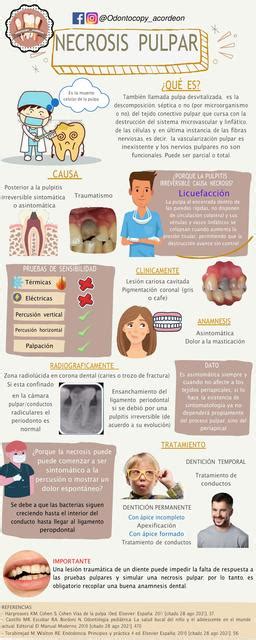 Necrosis Pulpar Odontocopy Acordeon UDocz