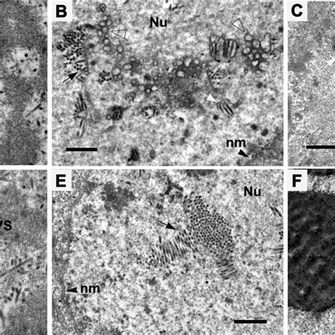 Transmission Electron Microscopy Analysis Of Sf9 Cells Transfected With